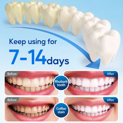 LED Teeth Whitening Strips Kit for Sensitive Teeth - 28 White Strips + 24 Blue Light Accelerator, 20Min Rapid White At-Home Dental Care for Smoking & Coffee Stains